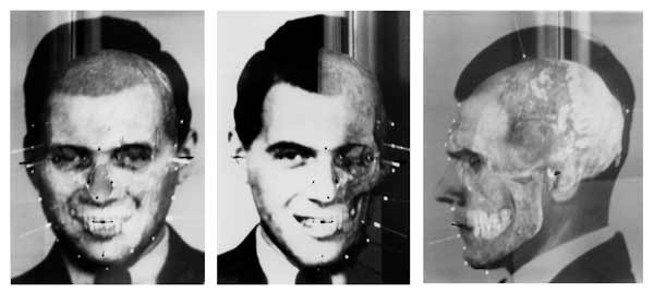 Images produced using photographs of Mengele and images of his skull in Richard Helmer’s face/skull superimposition demonstration, Medico-Legal Institute labs, São Paulo, Brazil, June 1985. © Richard Helmer, Courtesy Maja Helmer, 1985.