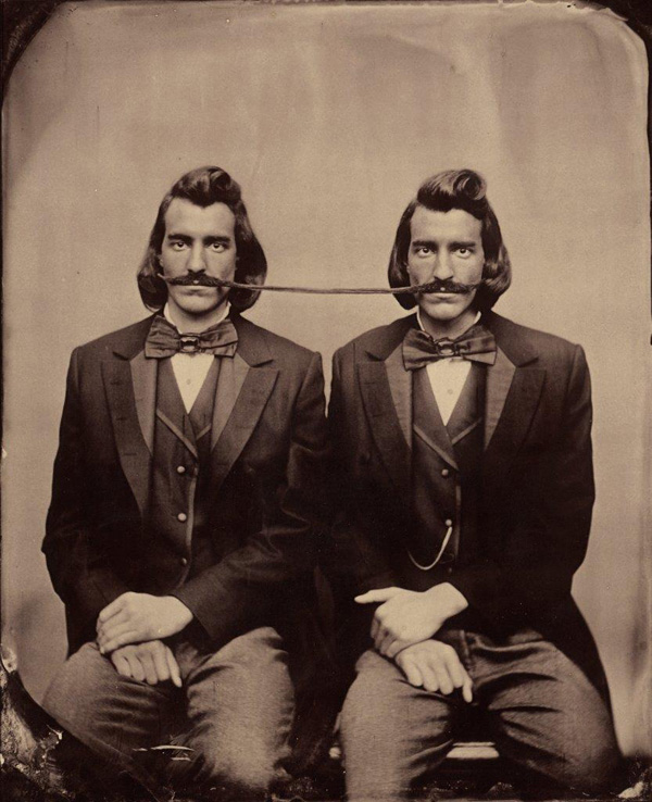 Stephen Berkman, Conjoined Twins, undated. Albumen print from we tplate collodion negative Courtesy the artist and Howard Greenberg Gallery