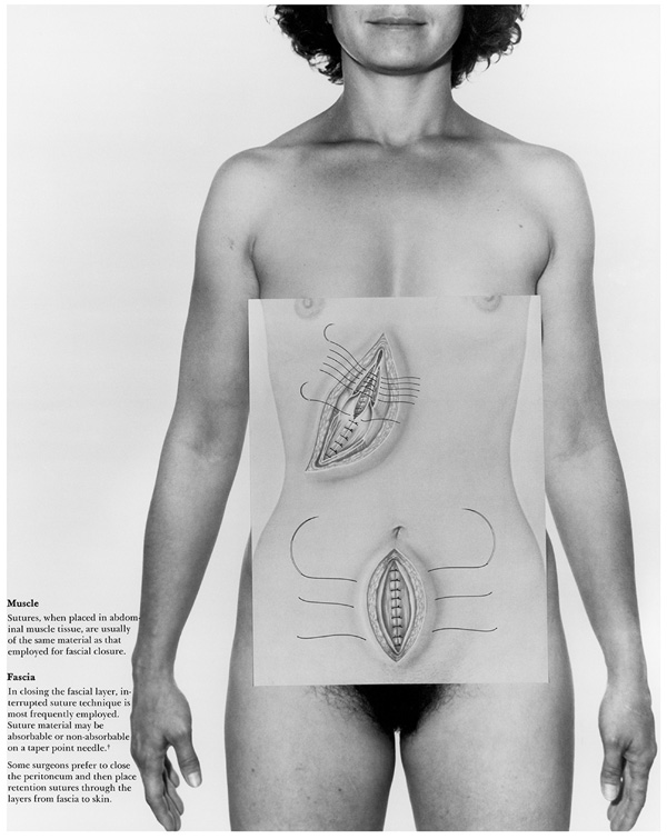 Donna-Lee Phillips Muscle/Fascia, from the series Anatomical Insights, 1978Courtesy Cherry and Martin, Los Angeles