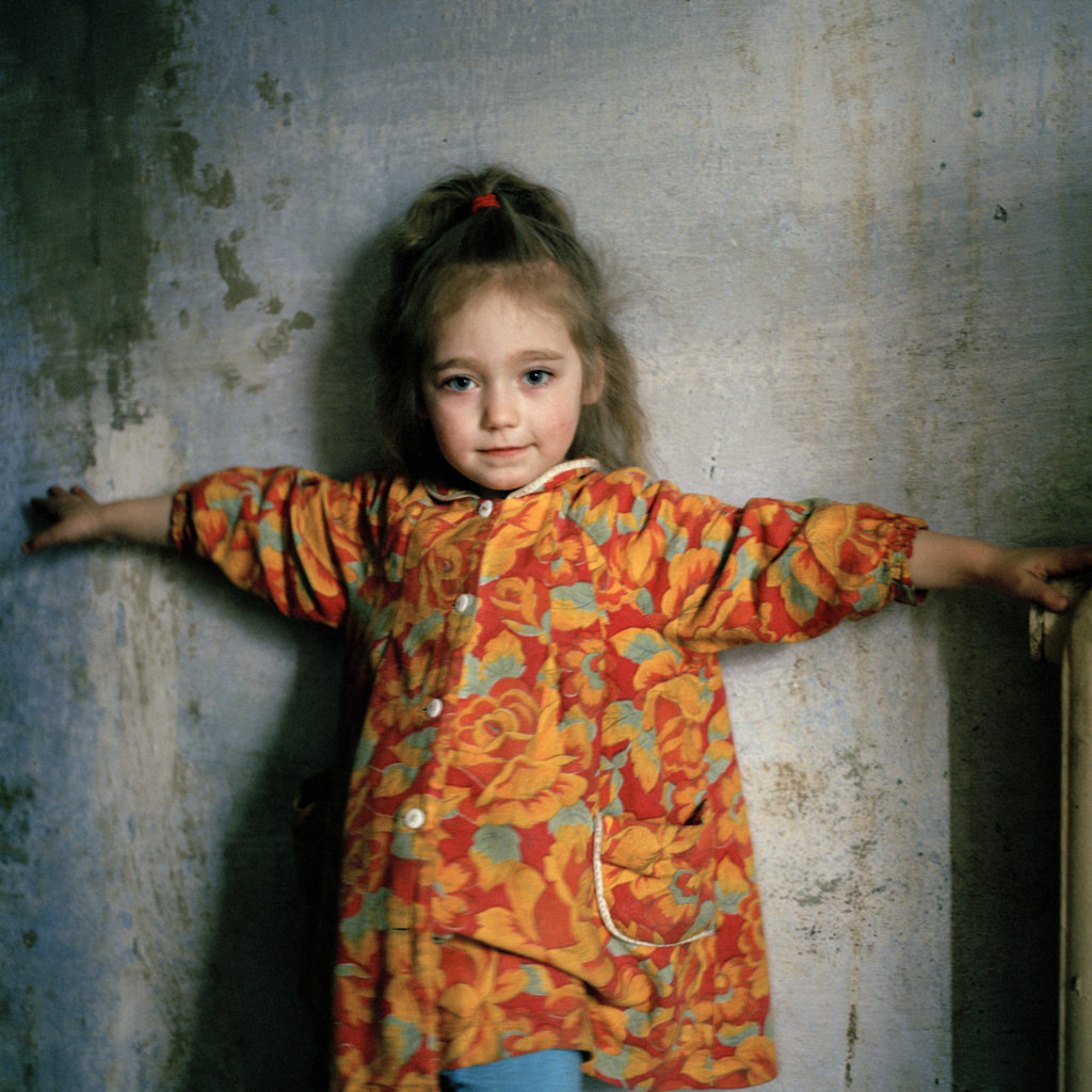 SmithTalk Masha, 6 years old, was infected with HIV through mother to child transmission at birth. Odesa, Ukraine, 2007