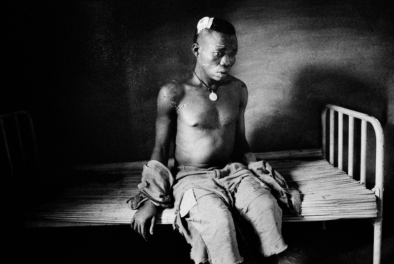 A Lendu soldier sits on a bed in a makeshift hospital in Drodro, Ituri province, Democratic Republic of Congo, DRC, in August 2003. Accused of cannibalism, the soldier was captured and beaten by the local Hema population. He now waits to learn of his fate. Ongoing conflict and the lack of access to medical care has claimed the lives of 5.4 million people in the DRC since 1998.